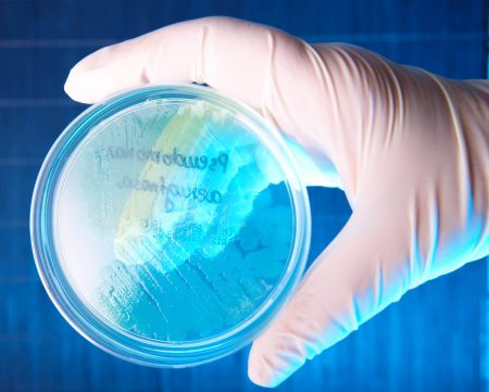Swimming Pool / Spa Microbial Water Analysis - Image 3