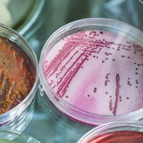Sulphate Reducing Bacteria Water Analysis