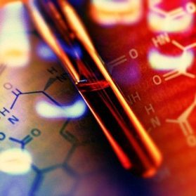 Laboratory Water Analysis